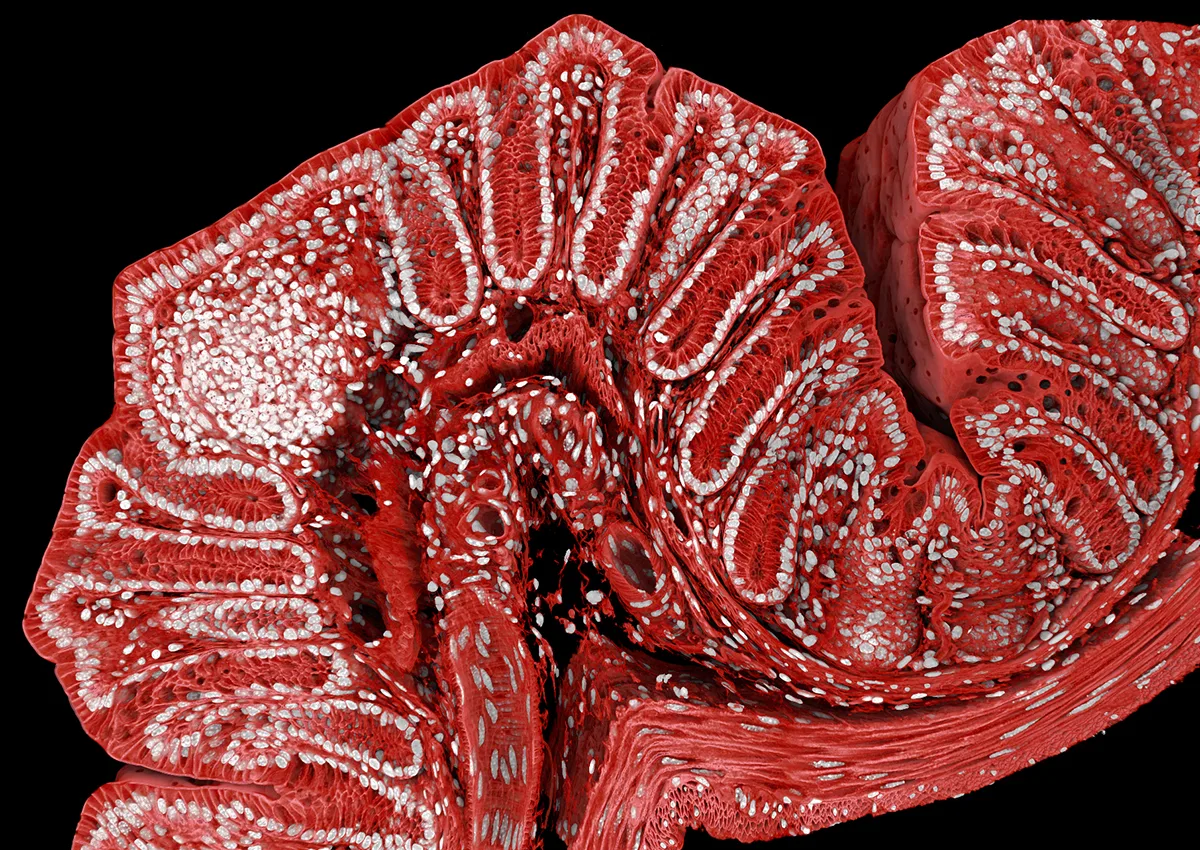 Red and white tubing curling around.