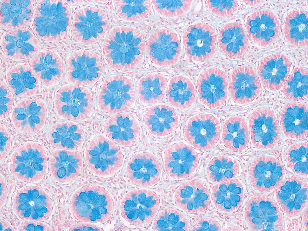 A pattern of blue flowers on a pink background. 