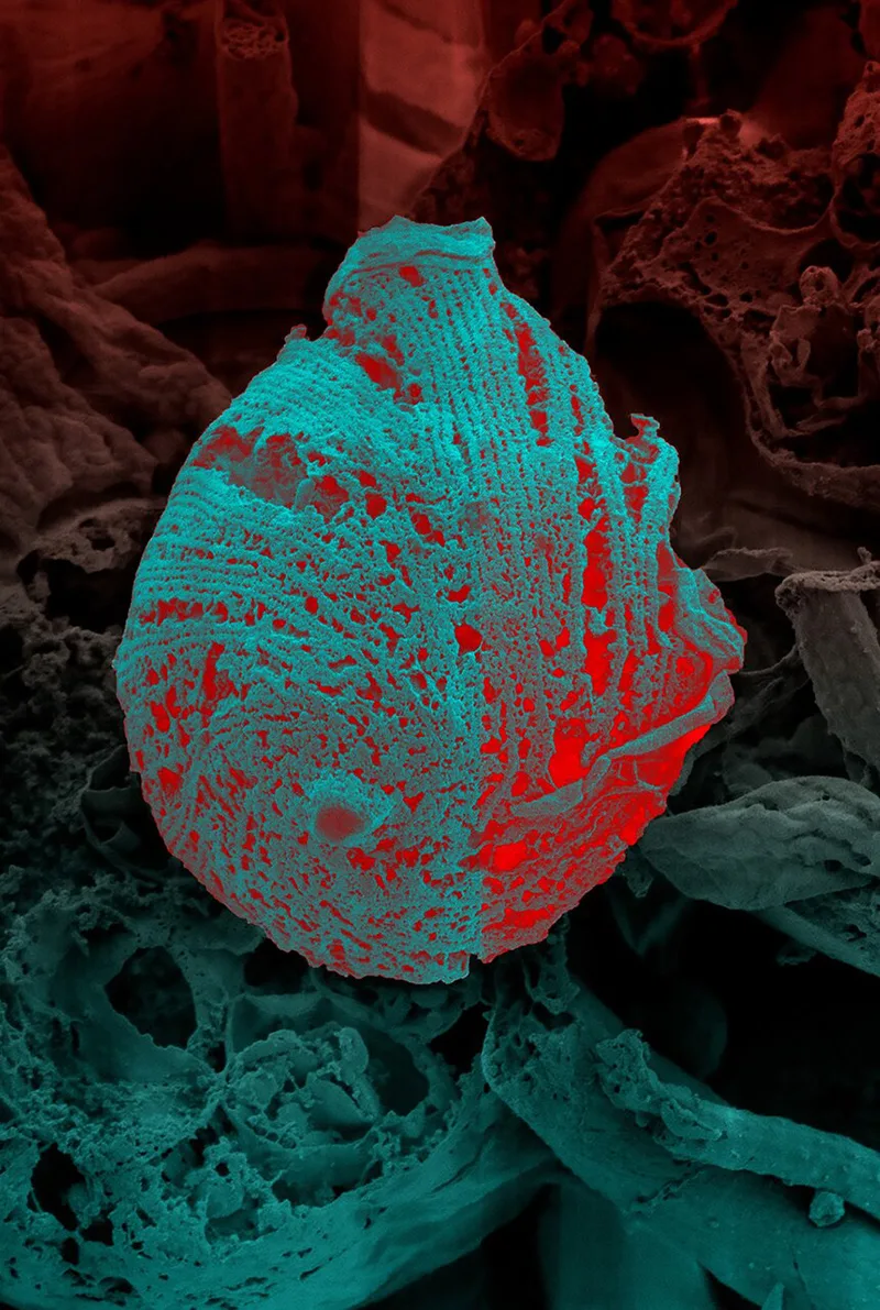 Red and green glowing ball parasite that causes Chagas disease.