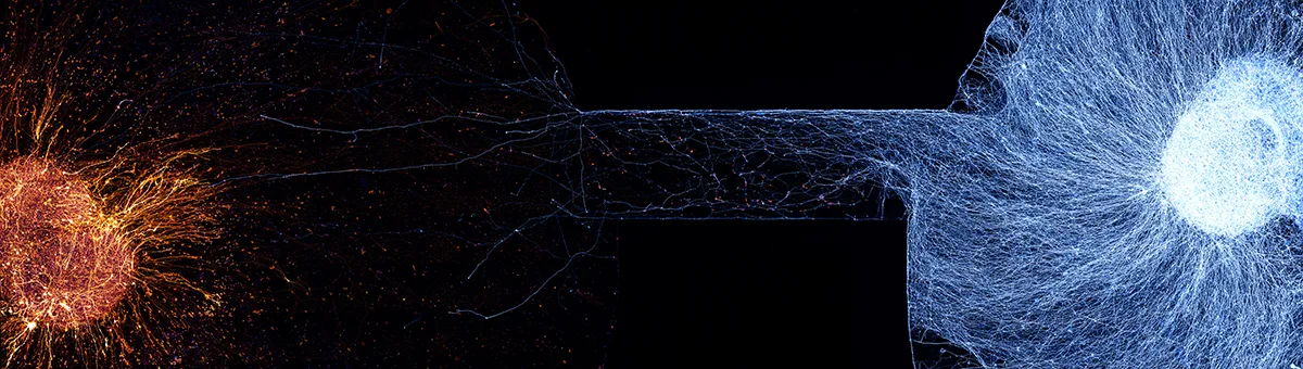 Orange ball on left with blue ball with strands right.